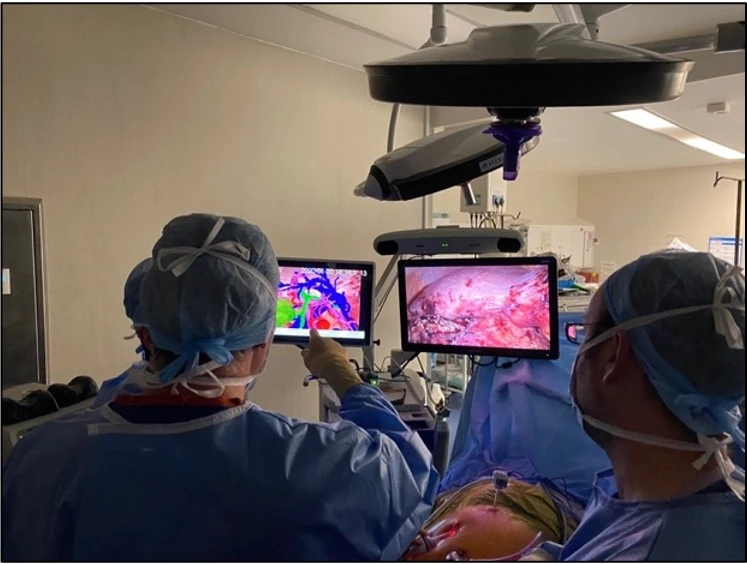 3D liver model and risk report